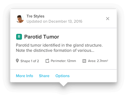 An annotation preview popover with statistics for shape perimeter and area.
