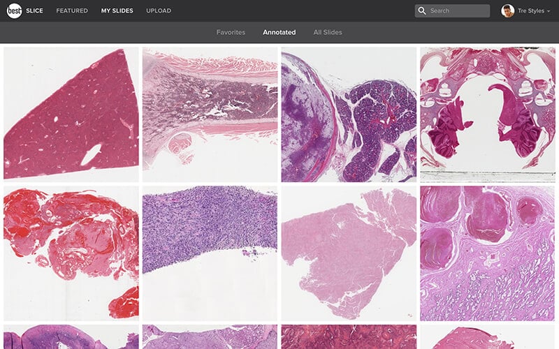 The new My Slides tab in slice, showing annotated and favorited slides.